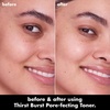 e.l.f. SKIN Thirst Burst Pore-fecting Toner, Hydrating for Face, Smooths, Plumps & Minimizes Pores, Infused with Salicylic Acid, Vegan & Cruelty-Free(4.7 Fl Oz (Pack of 1))