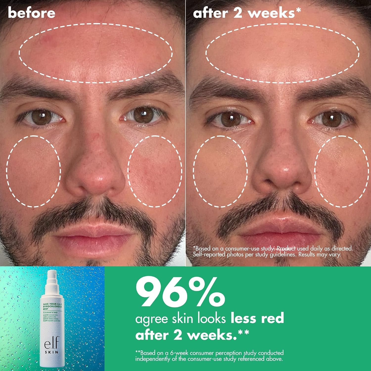 image:imageelf SKIN Save Your self Hypochlorous Mist