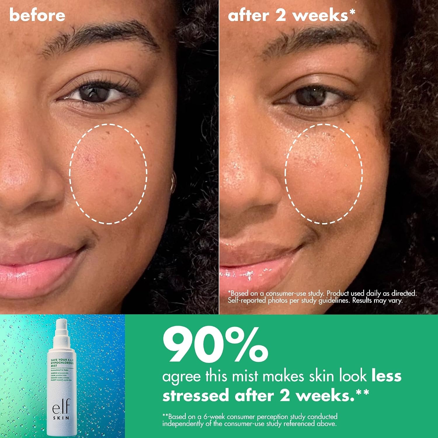 image:imageelf SKIN Save Your self Hypochlorous Mist