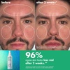 e.l.f. SKIN Save Your s.e.l.f. Hypochlorous Mist