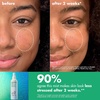 e.l.f. SKIN Save Your s.e.l.f. Hypochlorous Mist
